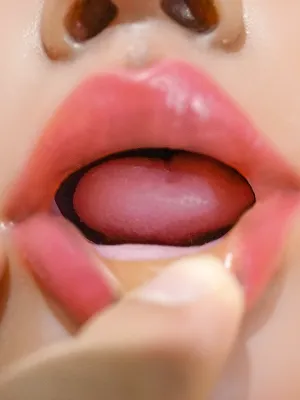Open Mouth
